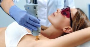 Лазерная эпиляция лица Киев Позняки стоимость