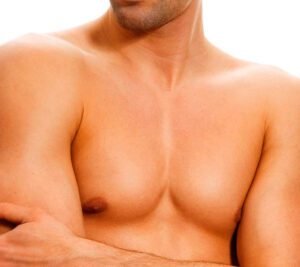 Лазерная эпиляция мужского бикини