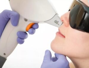 Лазерная эпиляция лица фото отзывы до и после