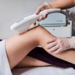 Лазерная эпиляция Киев цена Подольский район